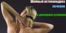 остеохондроза лекува