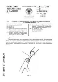 Спосіб аутовенозного протезування сегмента артерії кінцівки 12495 протезування