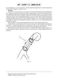 Спосіб аутовенозного протезування сегмента артерії кінцівки 12495 сегмента