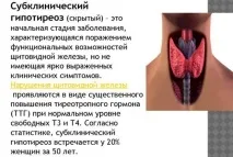 лікування