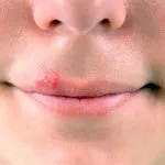 бързо устните