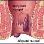 медицина лечение
