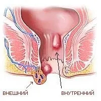 време хемороиди