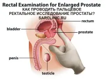 ректално дигитално