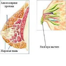 Медовий коржик при маститі - лікування народною медициною лікування