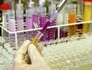 вируса имунната недостатъчност новини