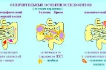 супозитории