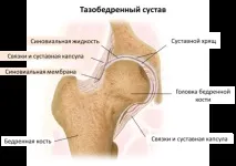 Тазостегновий суглоб людини його докладна будова та можливі патології суглоб