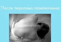 последствия последствия