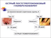 постстрептококов гломерулонефрит гнойни кожни