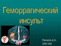 Презентація Геморагічний інсульт, Медицина геморагічний