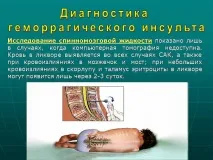 Презентація Геморагічний інсульт, Медицина інсульт