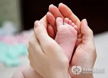 Синдактилія - причини, операція, реабілітація синдактилія