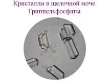 урината бременност