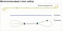 Стент у нирці установка, видалення, переваги та недоліки процедури - Живи Здорово стент