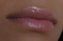 гланц гланц