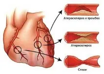 Судини серця людини (вени та артерії) анатомія та функції артерії