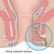 пета пета