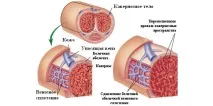 Варденафіл інструкція із застосування препарату інструкція