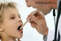 възпаление възпалено гърло