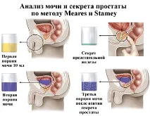 Аналіз секрету простати - що це і як його роблять, САЙТ ПРО ЗДОРОВ’Я ТА МЕДИЦИНУ аналіз