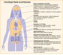 Анорексія та алкоголь причини розвитку та симптоми симптоми