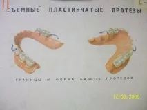 Базиси протезів Кордон