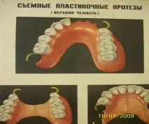 Базиси протезів обминаючи