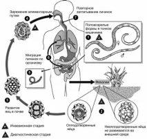 Аскарида людська (Ascaris lumbricoides) ascaris