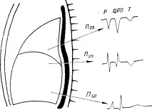 electrocardiogramă