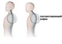 болестта болестта