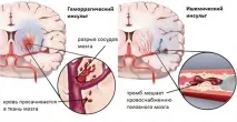 сибирската сибирската