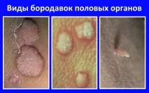 какво Какво направите