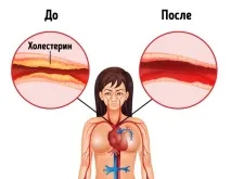 тялото тялото