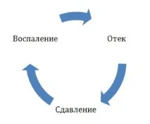 какво пулпит