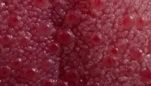 устната кухина също така