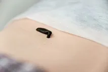 ефект върху пиявици