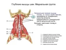 Глибокі М’язи Шії Як Зняти Спазм І Симптоми спазм