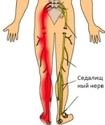 какви какви