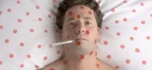 симптоми