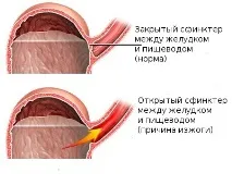 лекарства хапчета