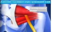 невро-урология