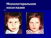 симптоми лечения