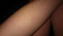 базата данни насекомите