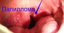 запалилася