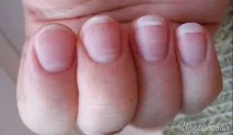 Vitram Beauty Краса врятує світ, а ось чи додасть здоров’я додасть