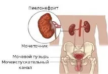 лечение