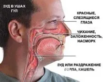 причини полиноза