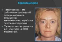 Запах ацетону з рота у дорослого причини і що робити рота