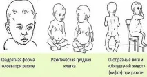 вітамін